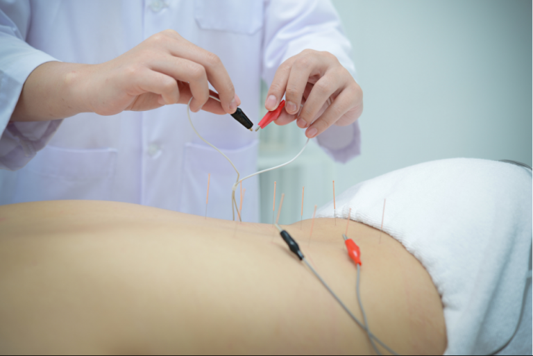 Electroacupuncture treatment